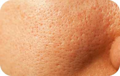 Zabiegi na rozszerzone pory wrocław