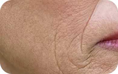 Zabiegi na starzenie się skóry wrocław