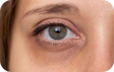 zabiegi na cienie i opuchlizne pod oczami